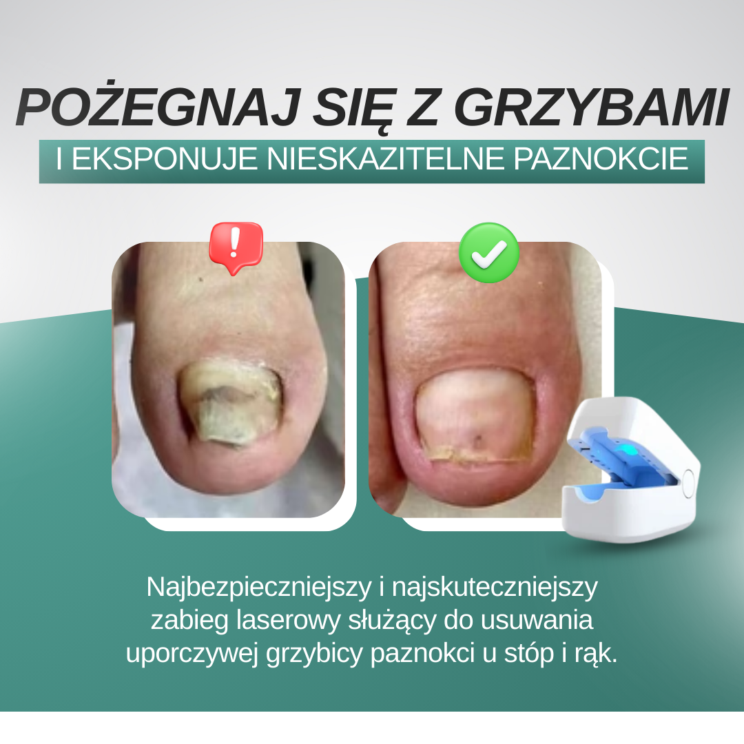 OrthoVital - Laser przeciwgrzybiczny